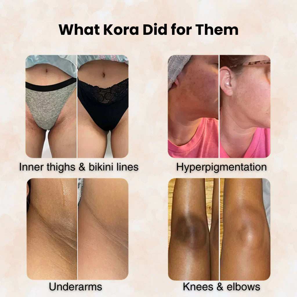 Turmeric & Kojic Acid - Skin Brightening Soap