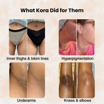 Turmeric & Kojic Acid - Skin Brightening Soap